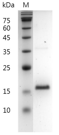 Human FGF-2（154 aa）protein