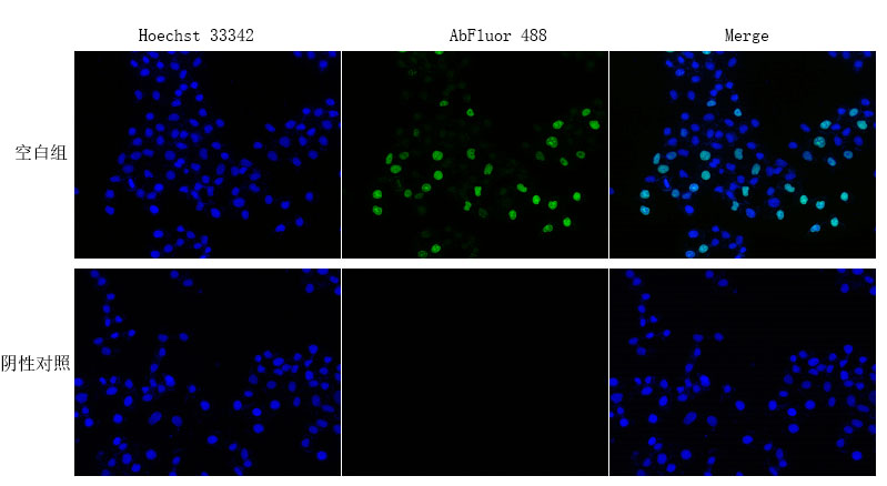 EdU Cell Proliferation Image Kit (Green Fluorescence)