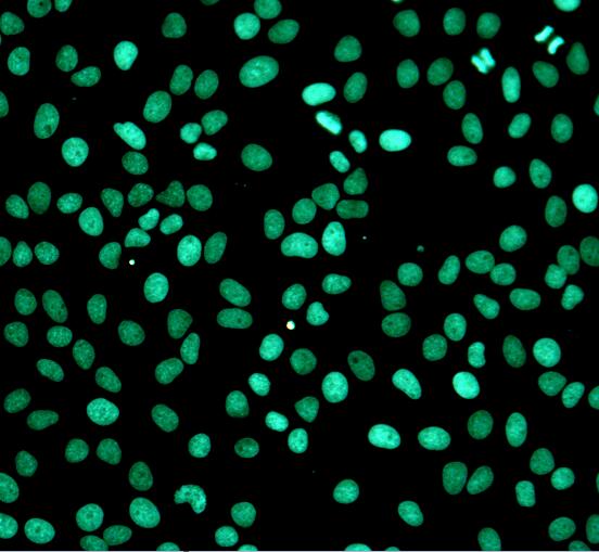 One-step TUNEL Apoptosis Assay Kit (Green Fluorescence)