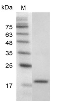 Mouse VEGF121 Protein, His tag (Animal-Free)