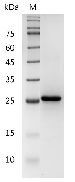 Human IL-34 Protein, His tag (Animal-Free)