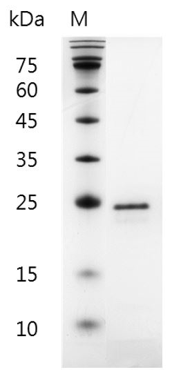 Human FGF-20 Protein, His tag (Animal-Free)