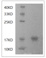 Human IFN-γ protein