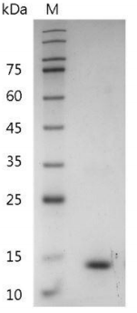 Mouse IL-31 Protein, His tag (Animal-Free)