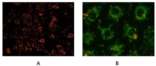 Mitochondrial Membrane Potential Assay Kit (JC-1)