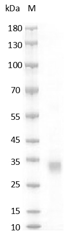 Mouse RSPO1/R-spondin-1 Protein